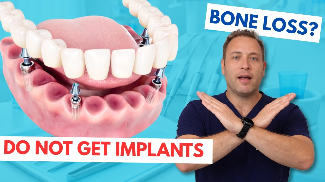 Teeth in a Day: What Most Dentists Won't Tell You About Immediate Loading
